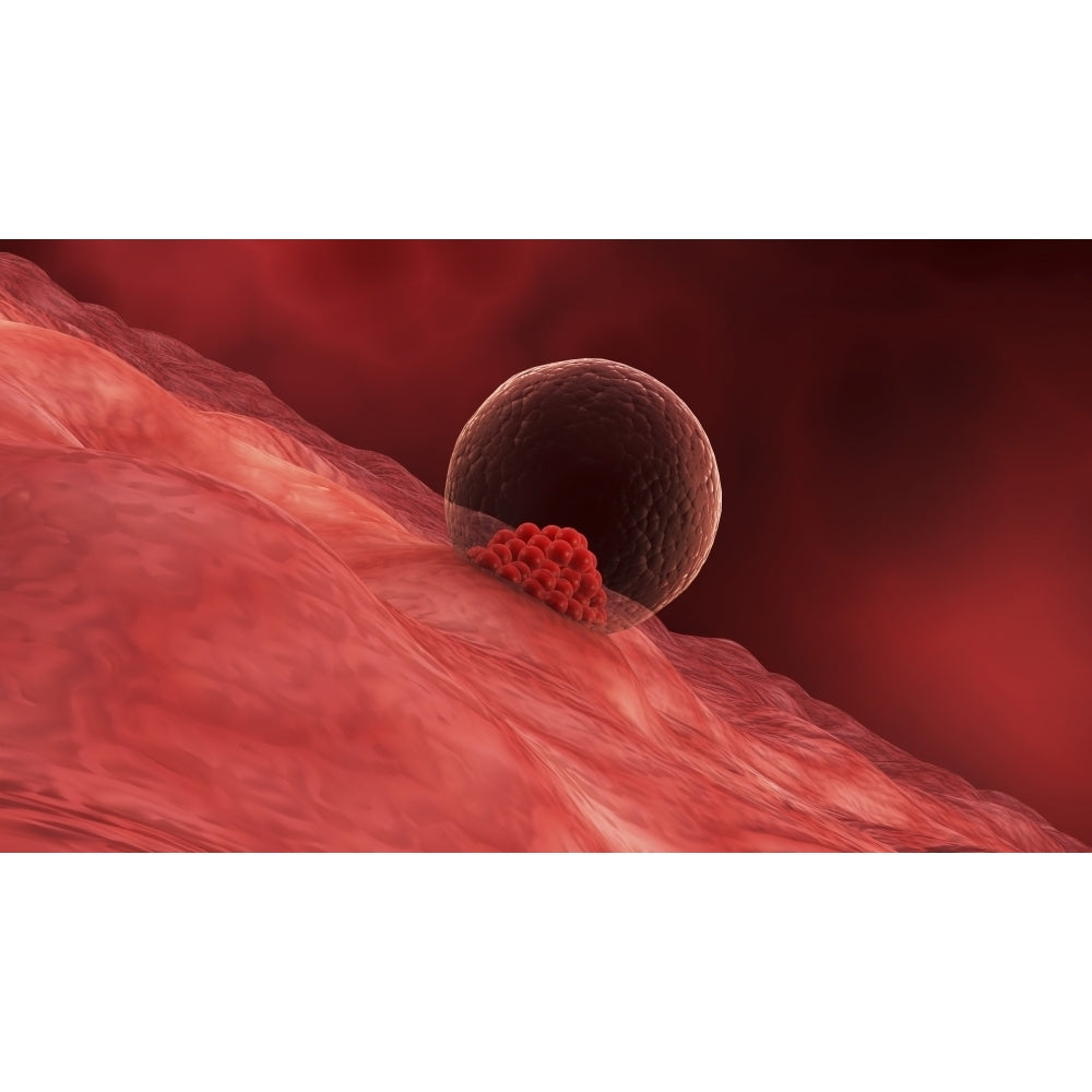 A blastocyst begins implanting in the wall of the uterus Poster Print Image 2