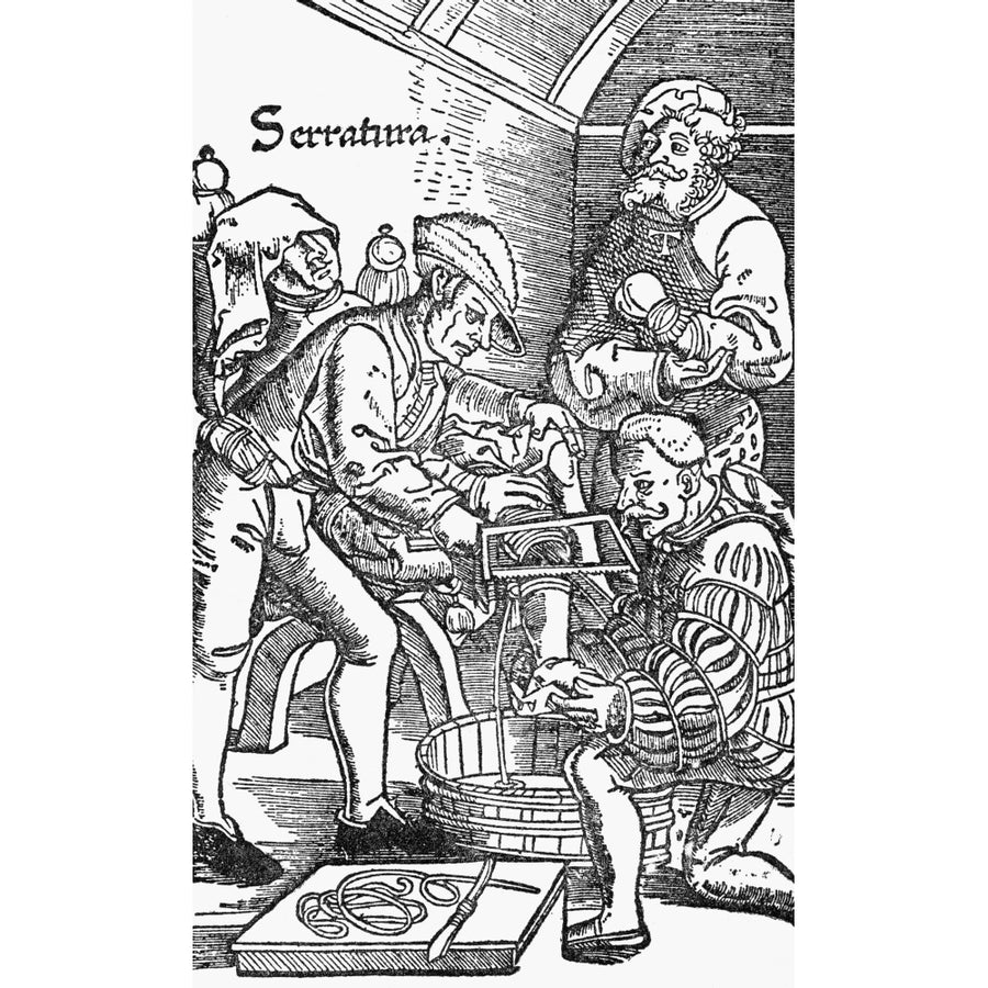 Sixteenth Century Amputation. Poster Print Image 1