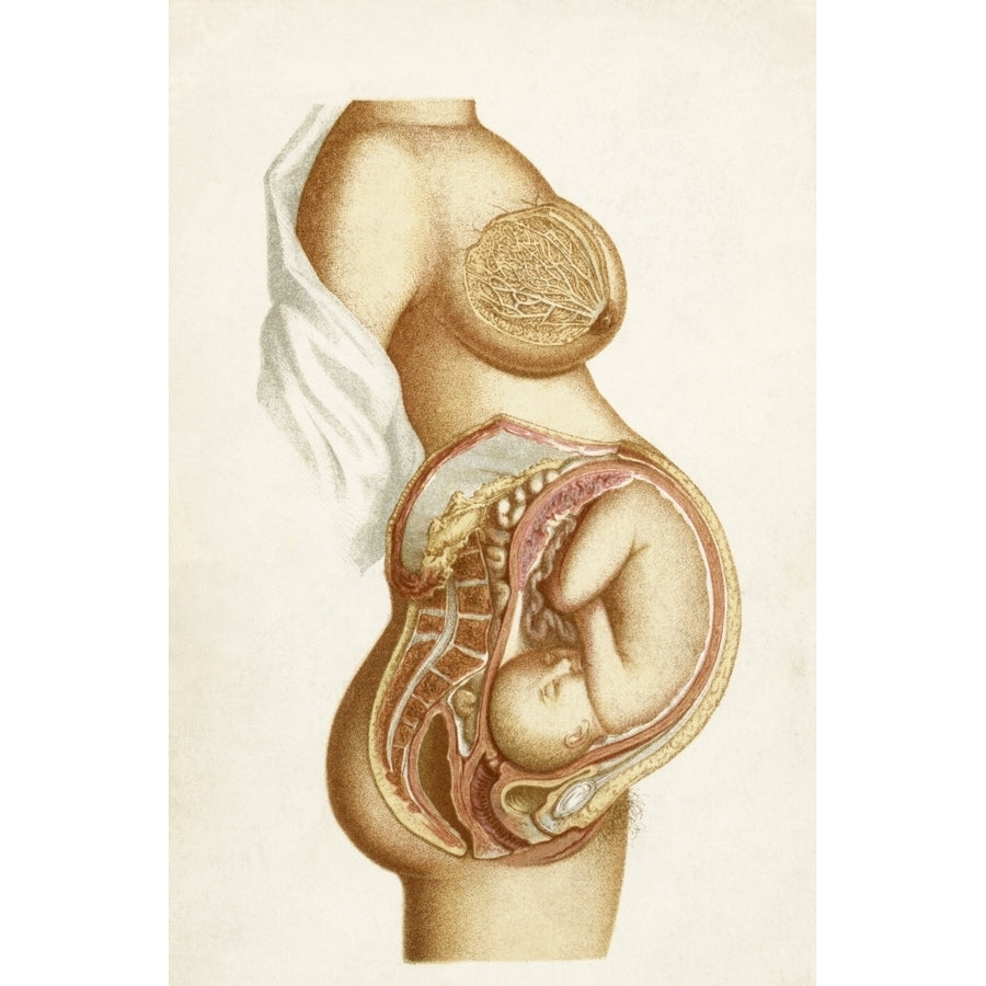 Semi-Diagrammatic Section Of A Full Time Pregnancy Showing Position Of Foetus In Utero From The Book Handbook Of Obstet Image 1