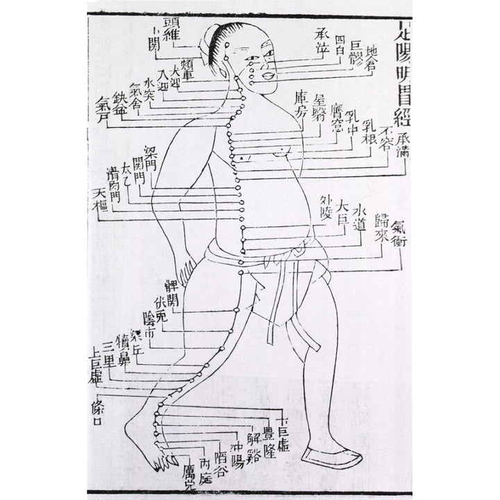 Figure With Acupuncture Points And Meridian For Stomach And Foot Disorders Annotated With Chinese Characters In A 1875 Image 2