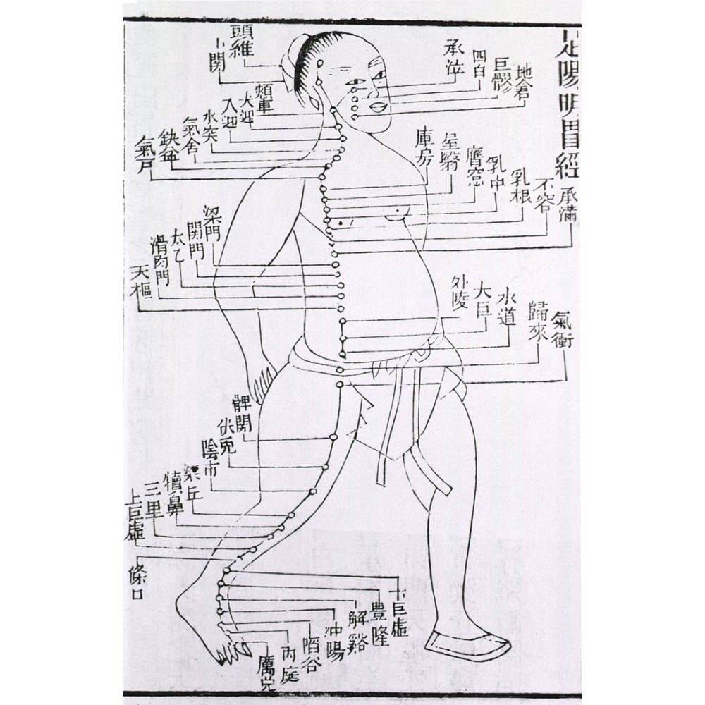 Figure With Acupuncture Points And Meridian For Stomach And Foot Disorders Annotated With Chinese Characters In A 1875 Image 1