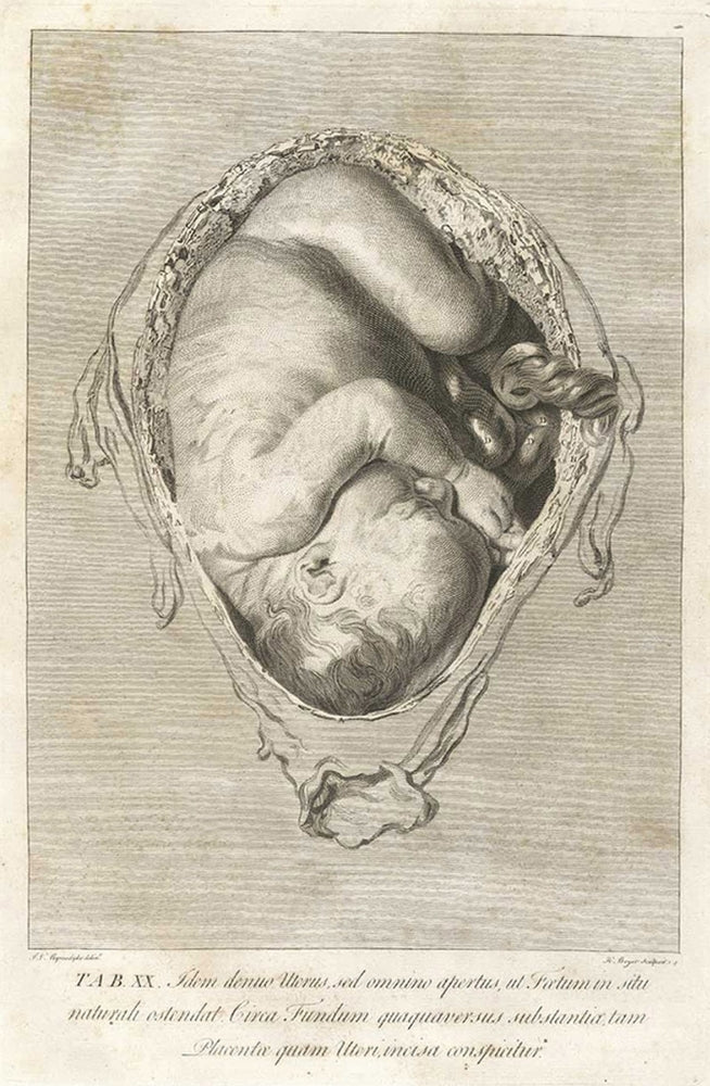 Fully Developed Human Fetus In Utero. Engraving From William HunterS The Anatomy Of The Human Gravid Uterus History Image 2