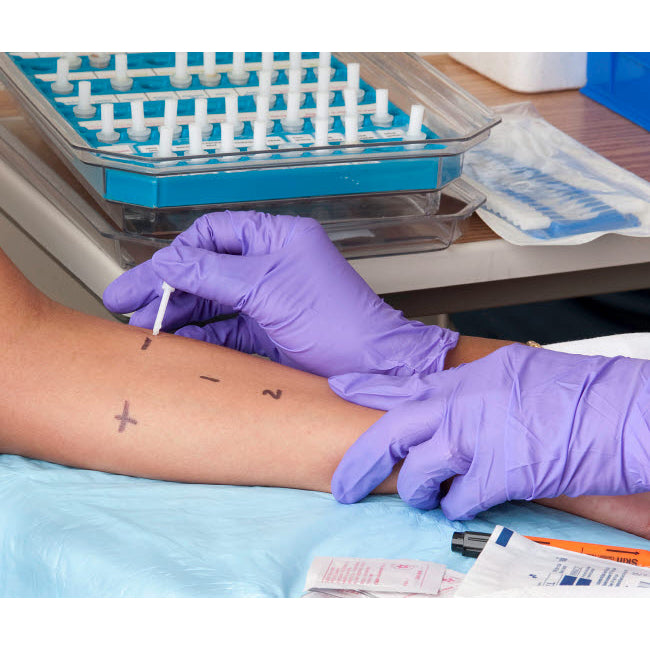 A person receiving a skin prick allergy test Poster Print by National Institutes of Health/Stocktrek Images Image 2