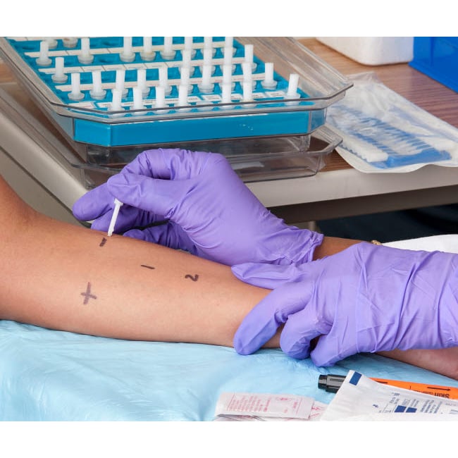 A person receiving a skin prick allergy test Poster Print by National Institutes of Health/Stocktrek Images Image 1