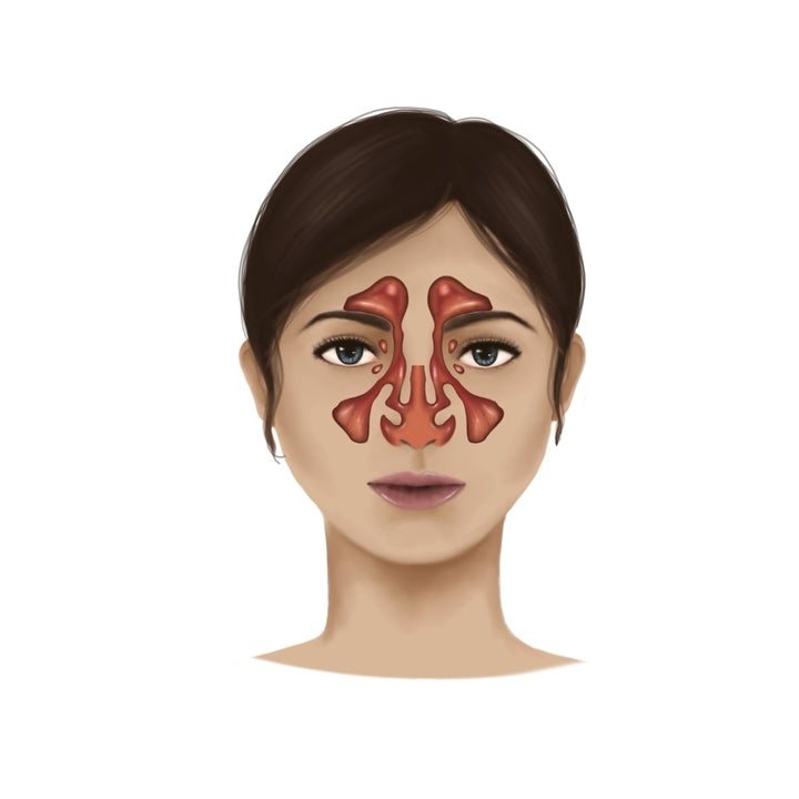 Anatomy of nasal sinuses Poster Print Image 1