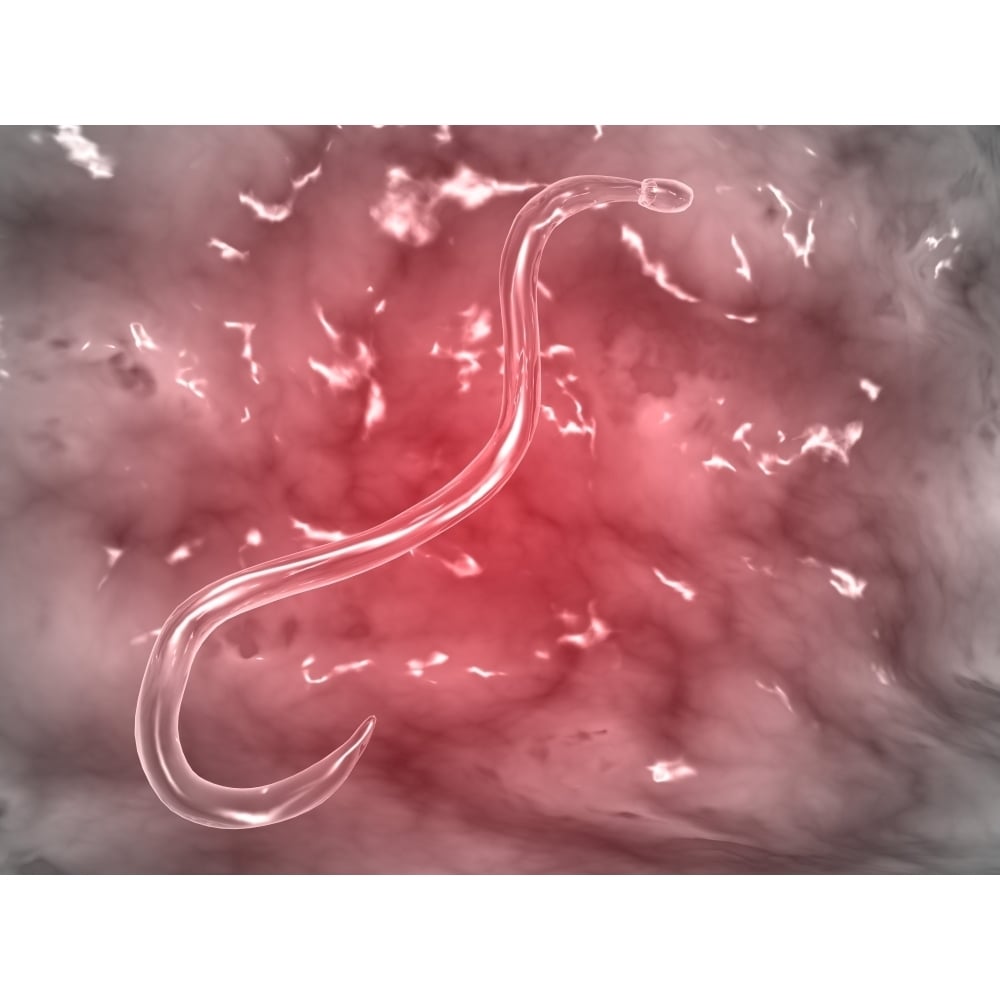 Microscopic view of hookworm Poster Print Image 1