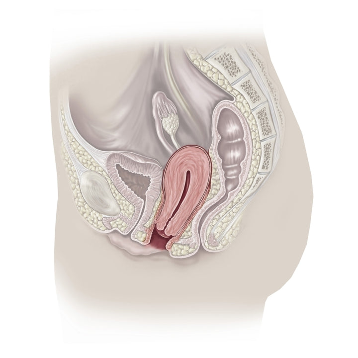 Sagittal section of pelvis showing prolapsed uterus. Poster Print by TriFocal Communications/Stocktrek Images Image 2