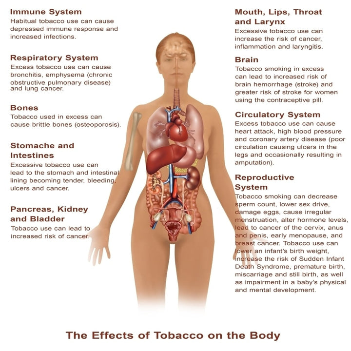 Effects of Tobacco Use Poster Print by Gwen ShockeyScience Source Image 2